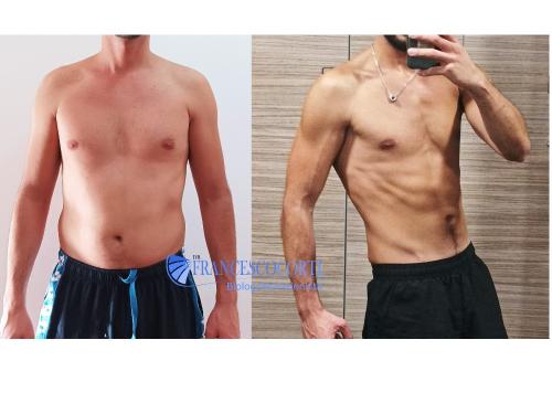 | Ricomposizione corporea |