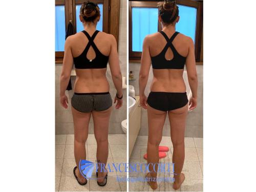 | Ricomposizione corporea |